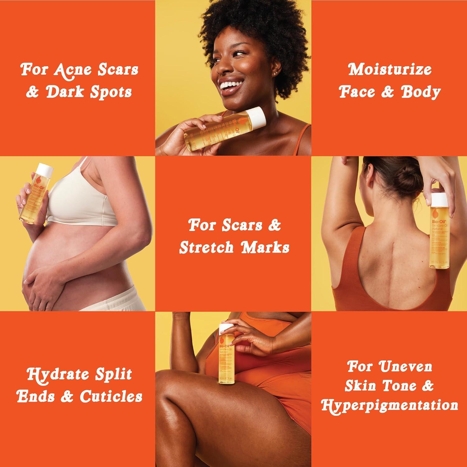 imageBioOil Natural Skincare Oil Serum for Scars and Stretch Marks Face and Body Moisturizer for Dry Skin Hair Oil For All Skin Types 42 Oz67 Fl Oz Pack of 1